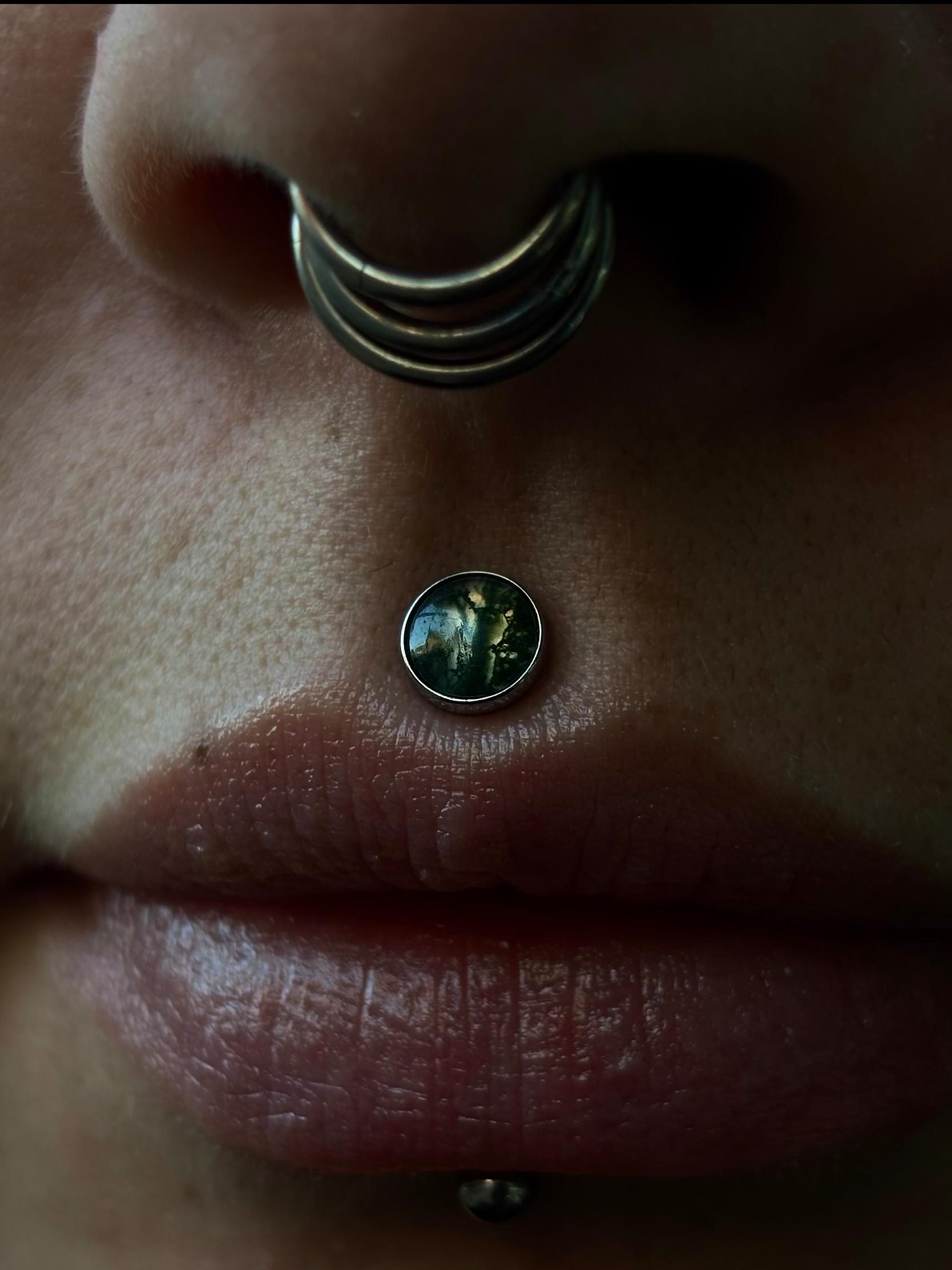 Philtrum
