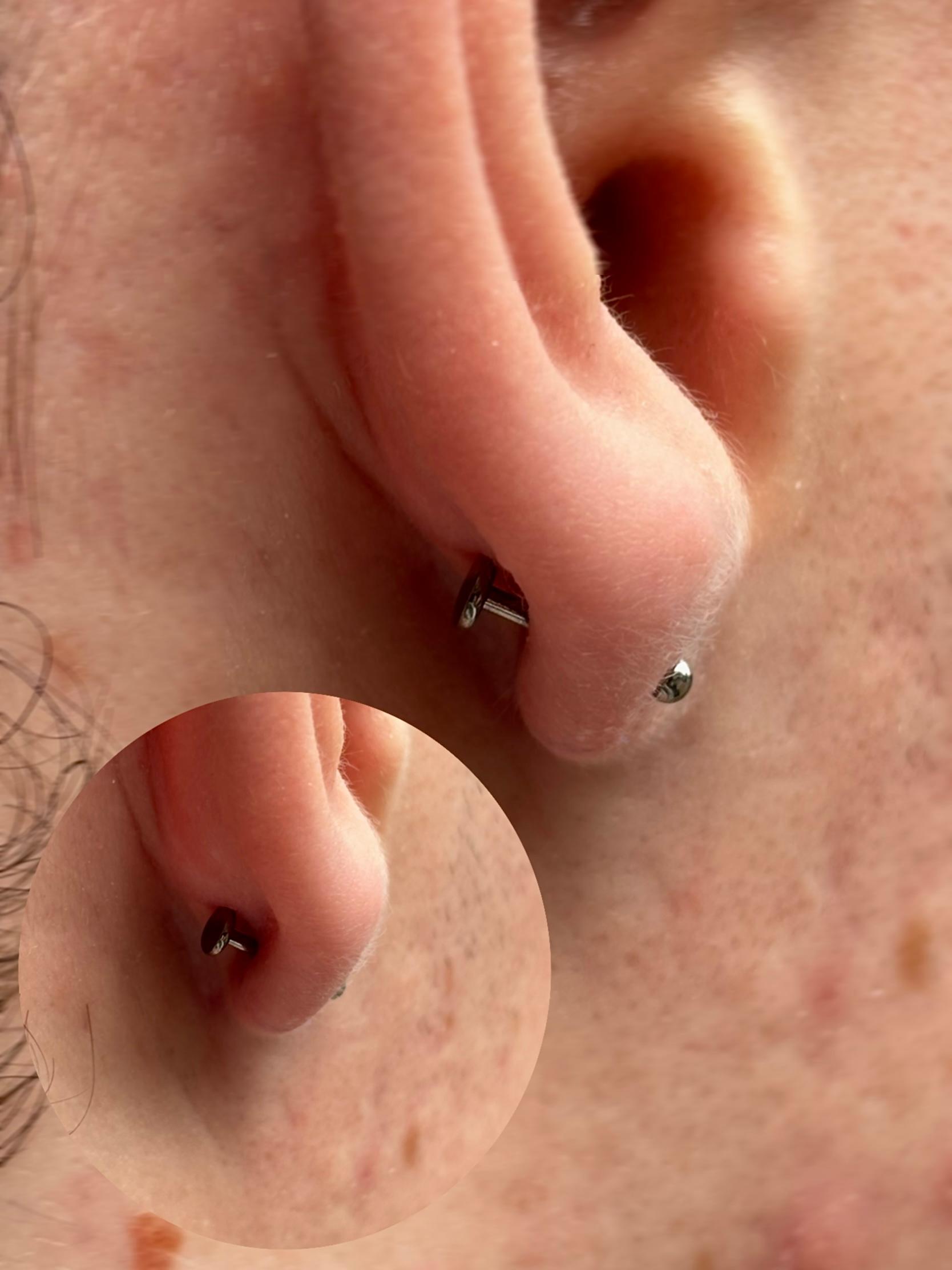 Single Earlobe