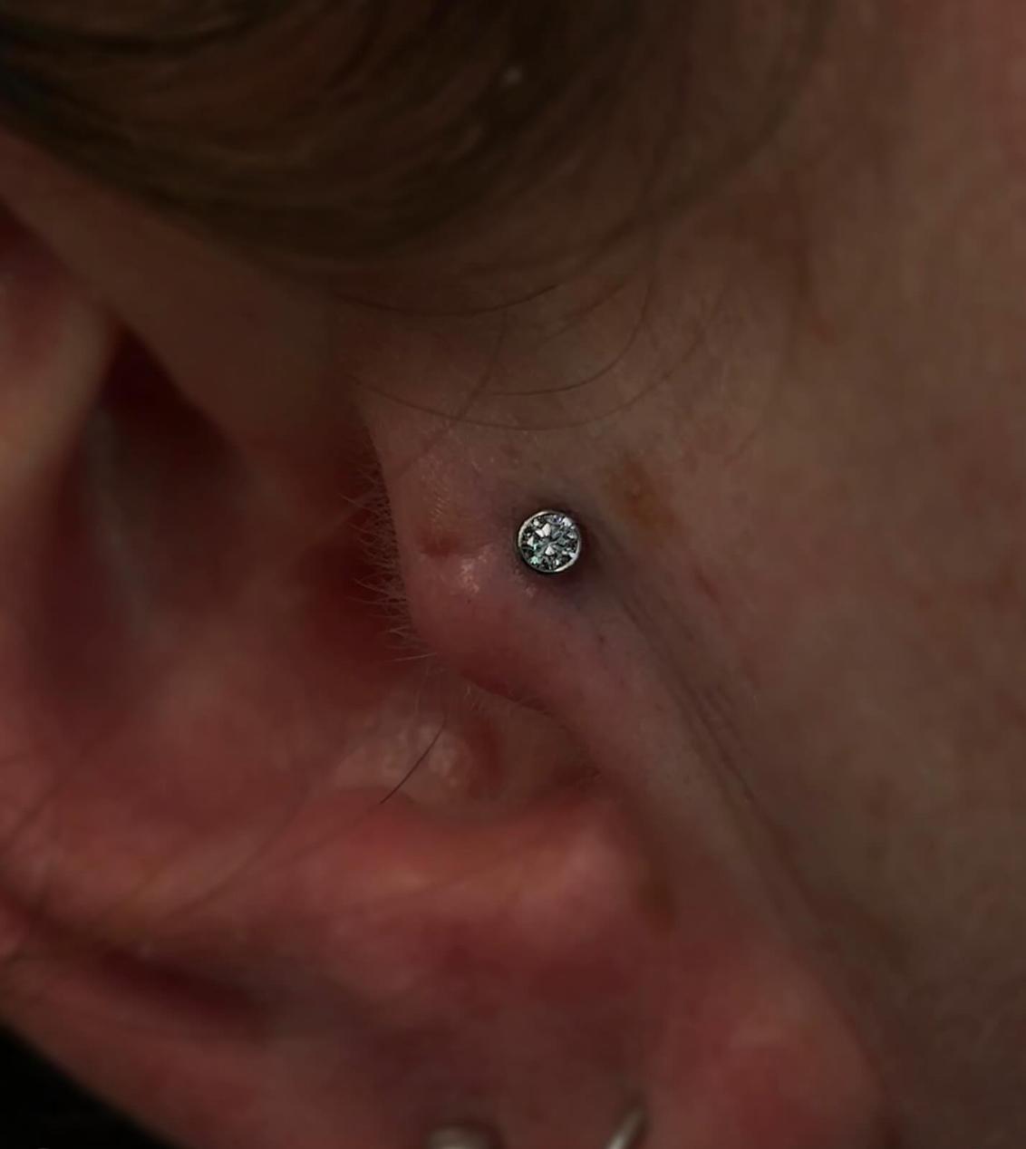 Tragus