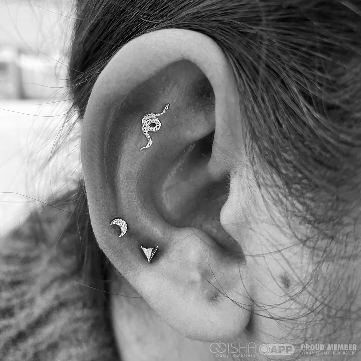 Ear Curation Consultation