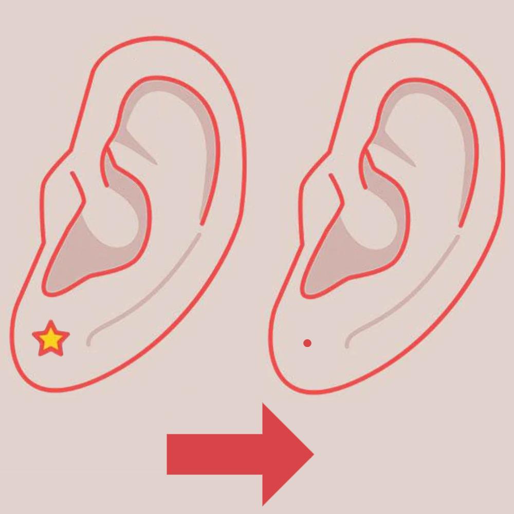 Jewelry / Piercing Removal